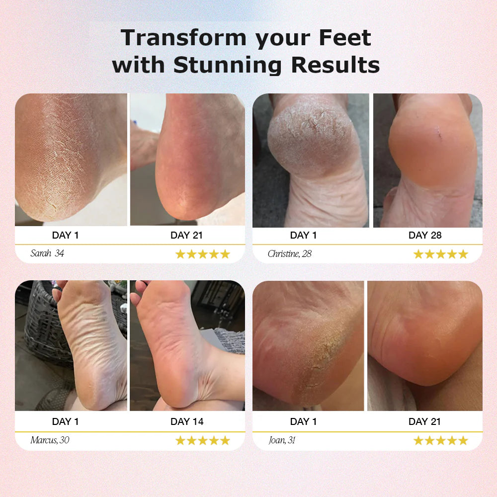 LUSHE Foot Callus Remover